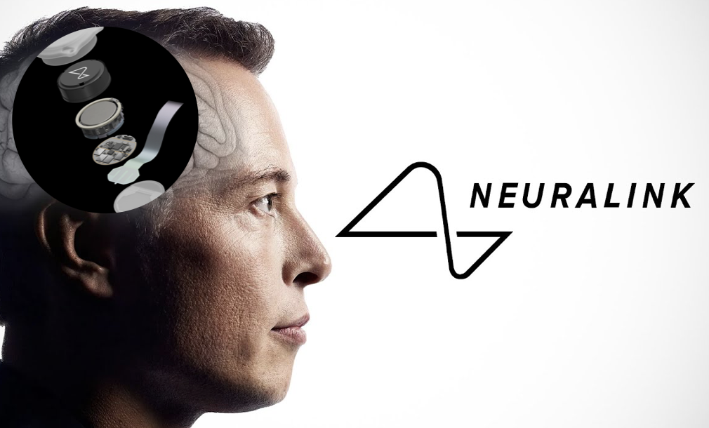 神經科技公司Neuralink獲FDA批准進行首次人體臨床研究，馬斯克未來將親自植入