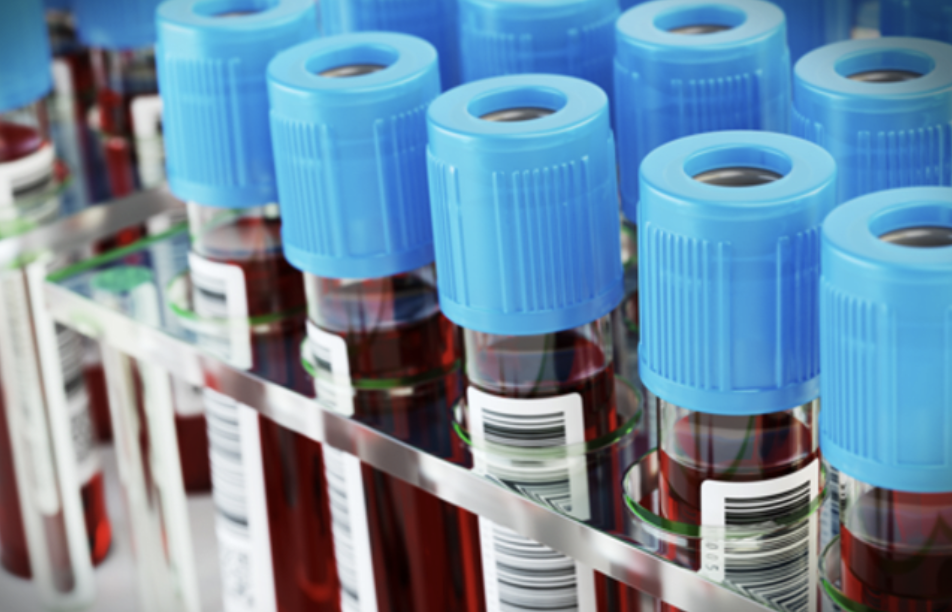 壞血不再是矽谷新創騙局！醫療商竟實現 Theranos 產品，已獲得 FDA 認證