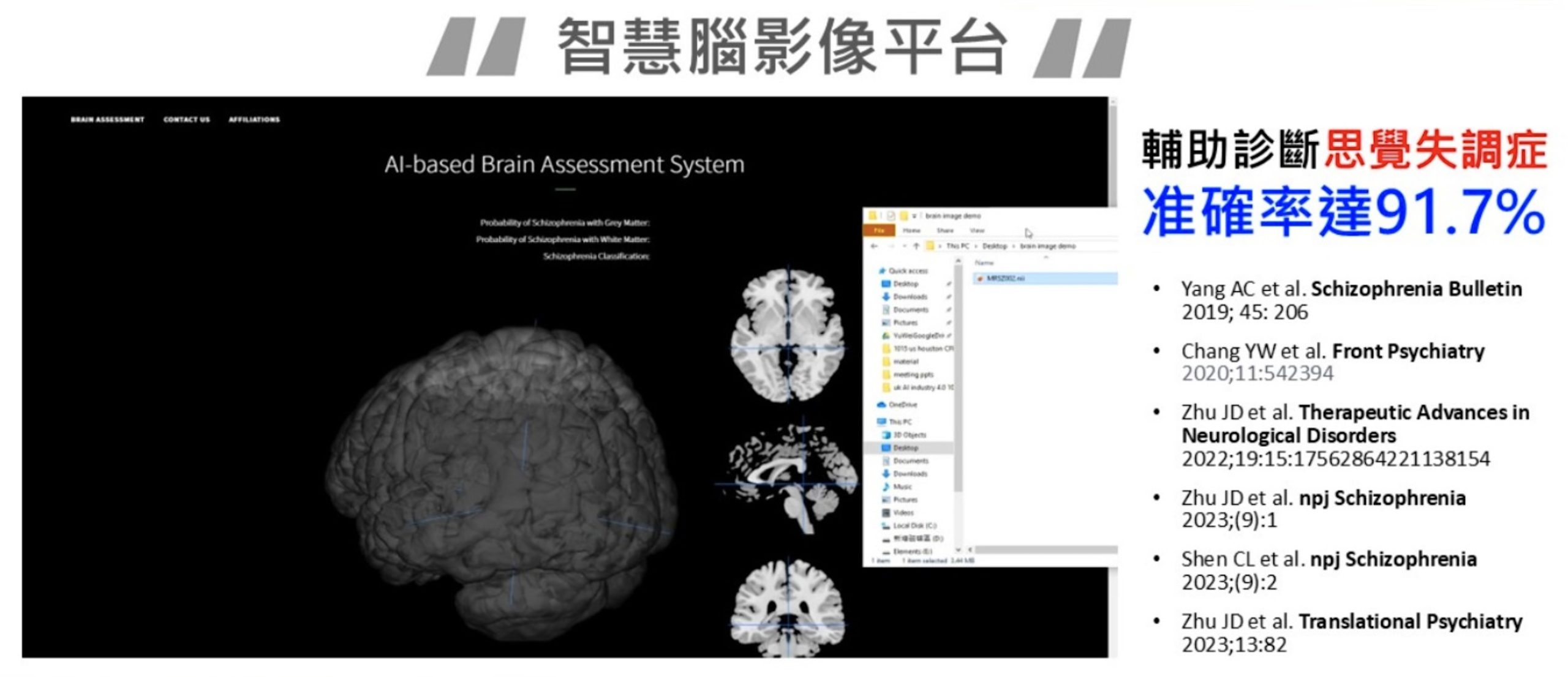 卡陰撞邪不用怕！北榮發表全球首創智慧腦影像平台幫助思覺失調患者